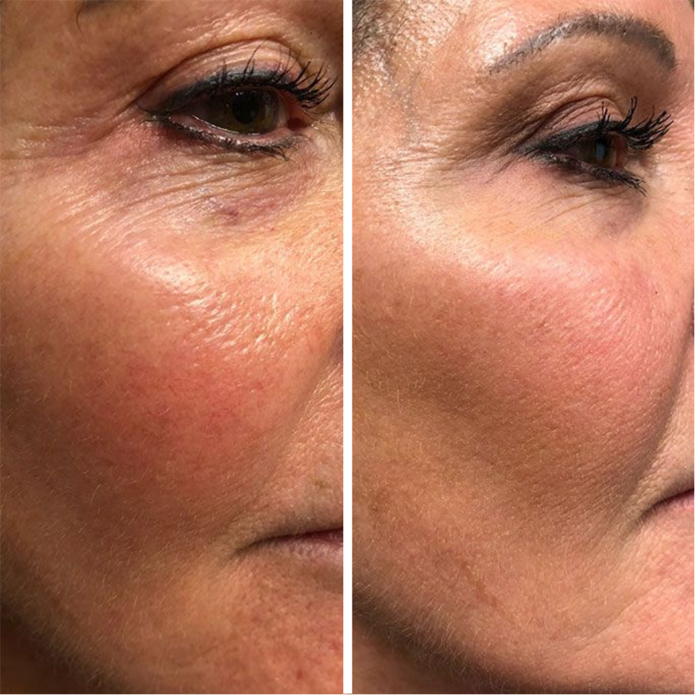 <p>Real Results, Visibly Different</p>