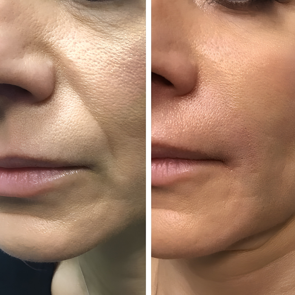 <p>Real Results, Visibly Different</p>
