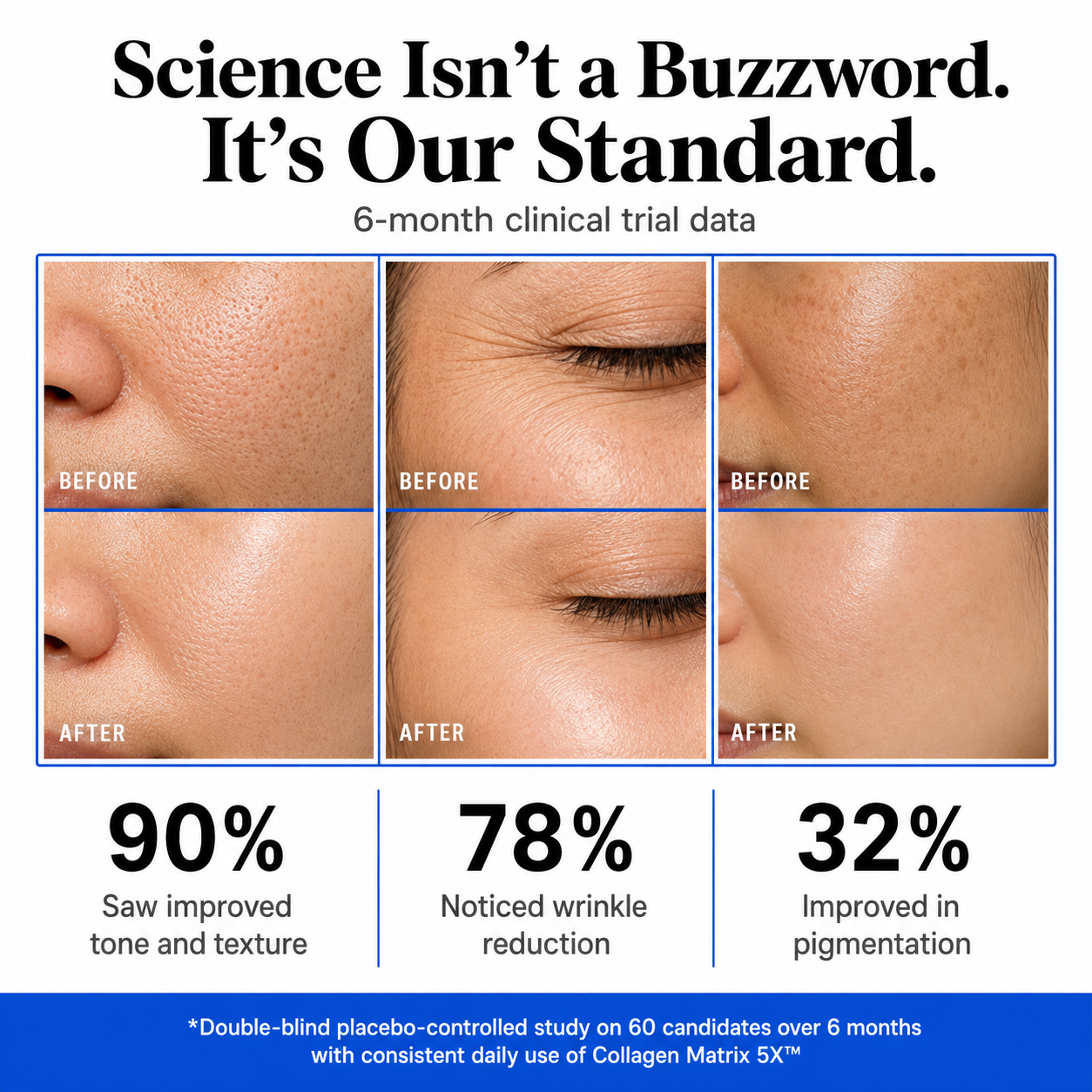Advanced Multi-Collagen Support for Total Wellness.